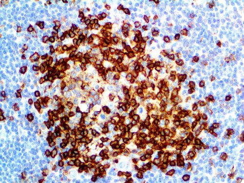 IHC of CD43 on an FFPE Tonsil Tissue
